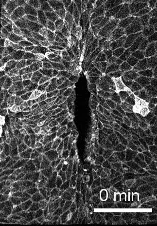 Hindbrain Neuropore Tissue Geometry Determines Asymmetric Cell Mediated Closure Dynamics In Mouse Embryos Pnas