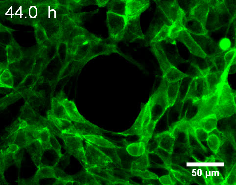 Actin Ring Segment Switching Drives Nonadhesive Gap Closure Pnas