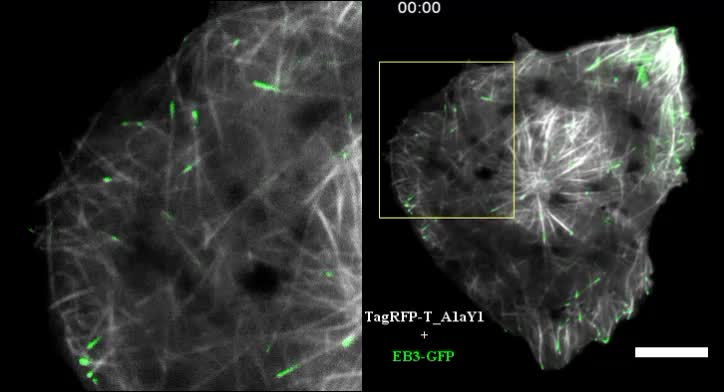 Genetically encoded live-cell sensor for tyrosinated microtubules ...