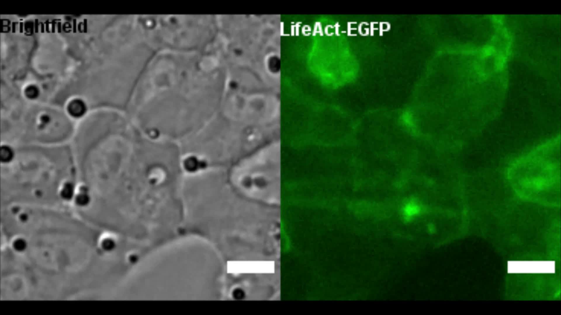 Anisotropic expansion of hepatocyte lumina enforced by apical ...