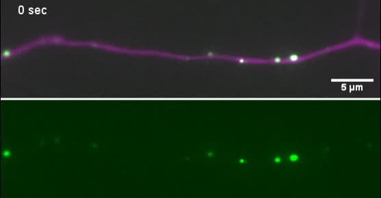 A septin GTPase scaffold of dynein–dynactin motors triggers retrograde  lysosome transport | Journal of Cell Biology | Rockefeller University Press