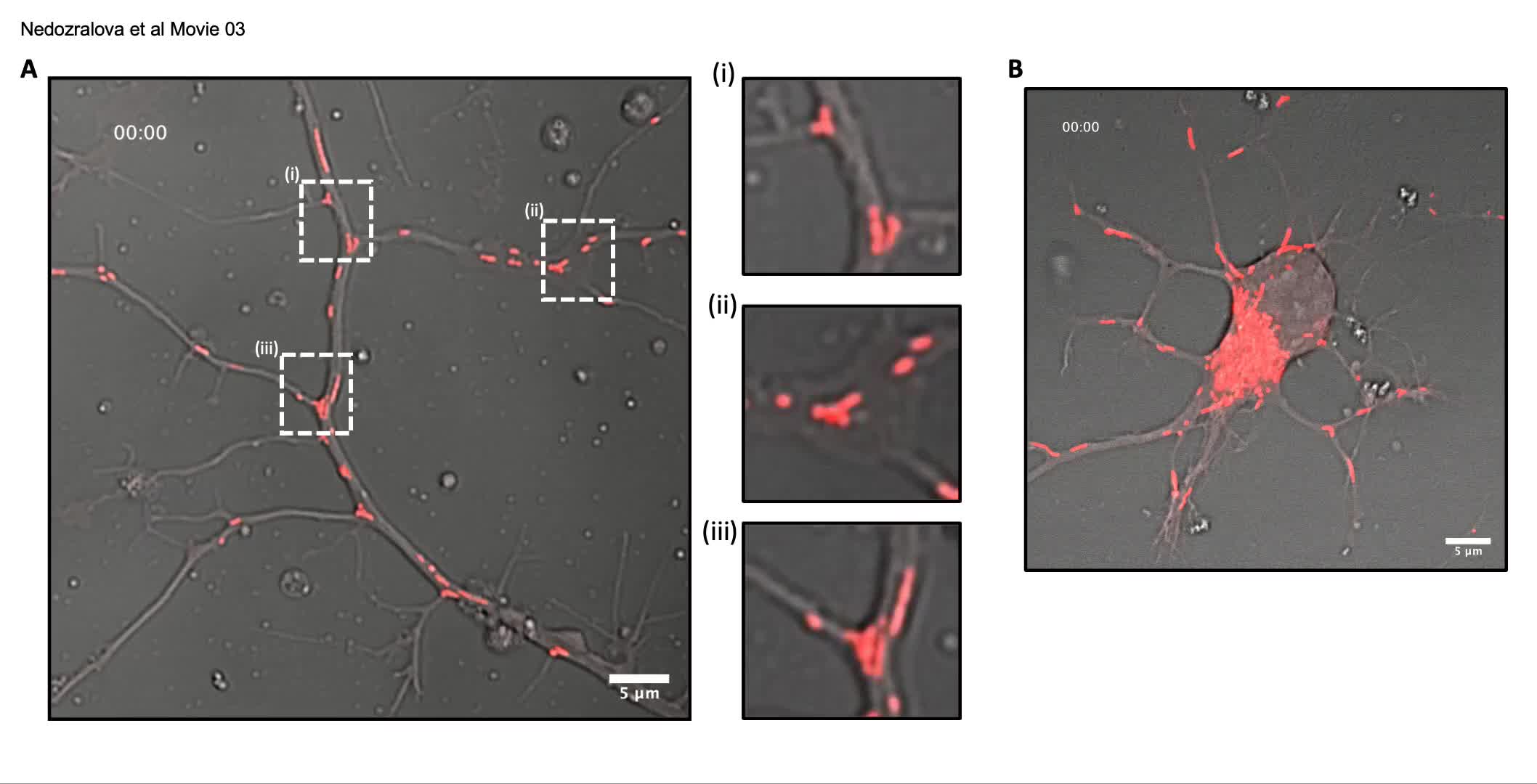 In situ cryo-electron tomography reveals the asymmetric