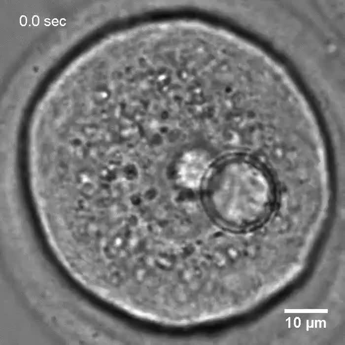 Active diffusion in oocytes nonspecifically centers large objects ...