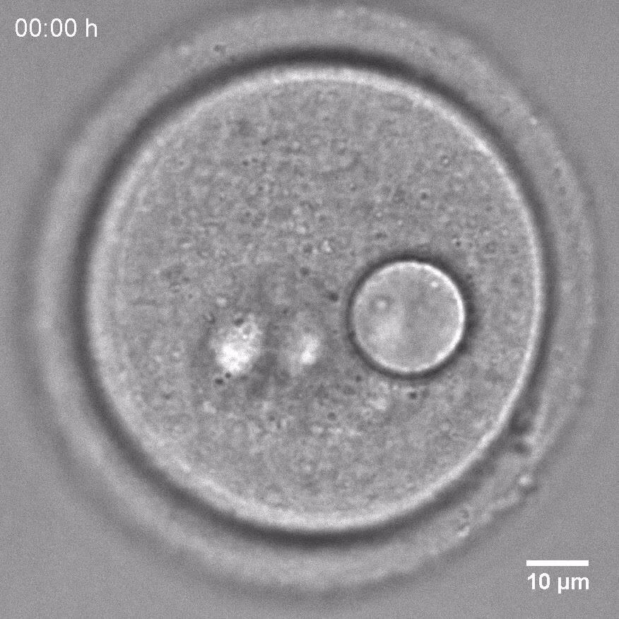 Active diffusion in oocytes nonspecifically centers large objects ...