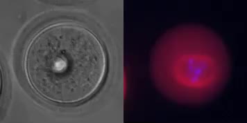 Polar body formation: new rules for asymmetric divisions